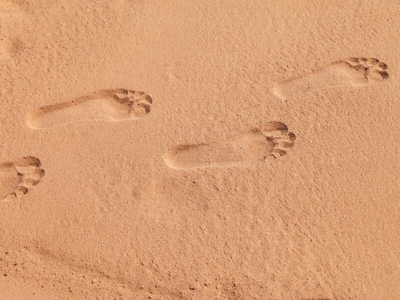 Conséquences du pied plat valgus non traité et complications